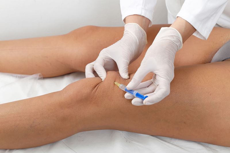 Hyaluronic Acid Injections - Cork Surgery - Orthopaedic & Sports ...